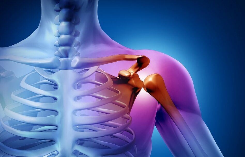 shoulder joint injury from arthrosis