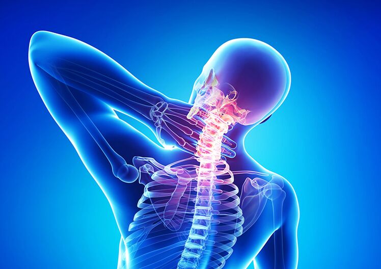 Spinal osteochondrosis is a disease that affects the articular cartilage and vertebrae.
