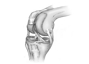 Difference between joint injuries